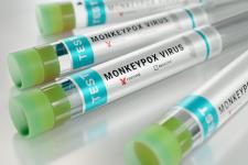 Monkeypox tests