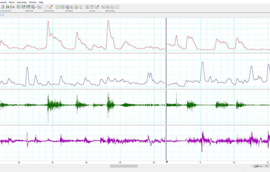 A chart of electromagnetic waves